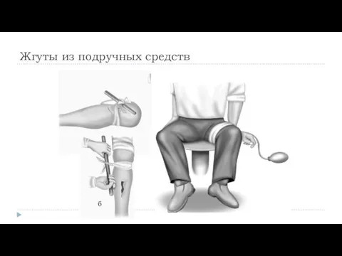 Жгуты из подручных средств