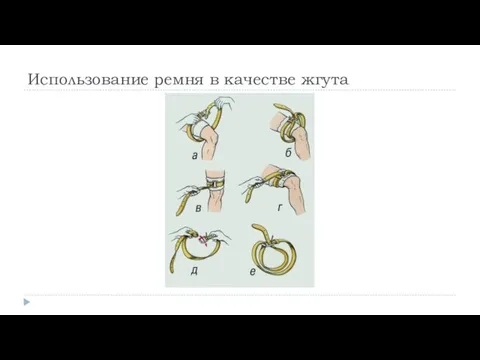 Использование ремня в качестве жгута