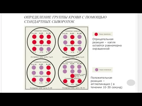 ОПРЕДЕЛЕНИЕ ГРУППЫ КРОВИ С ПОМОЩЬЮ СТАНДАРТНЫХ СЫВОРОТОК Положительная реакция – агглютинация ( в