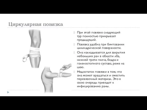 Циркулярная повязка При этой повязке следующий тур полностью прикрывает предыдущий. Повязка удобна при