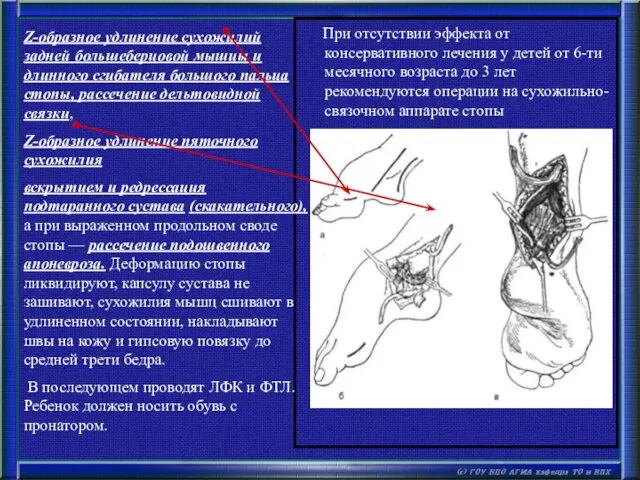 При отсутствии эффекта от консервативного лечения у детей от 6-ти