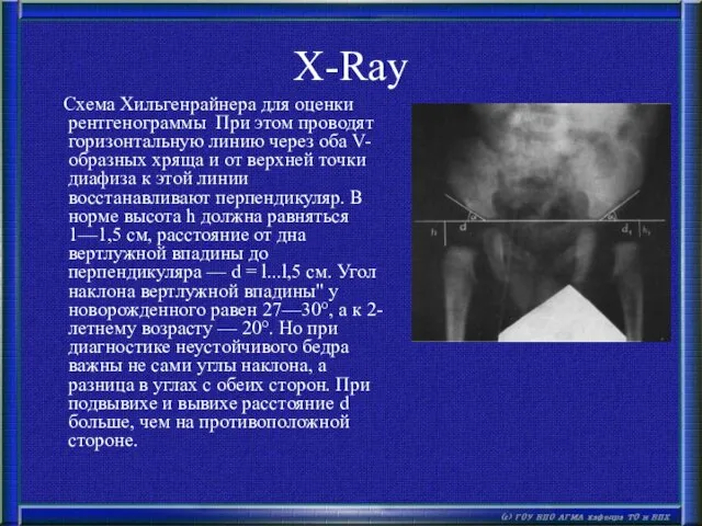 X-Ray Схема Хильгенрайнера для оценки рентгенограммы При этом проводят горизонтальную