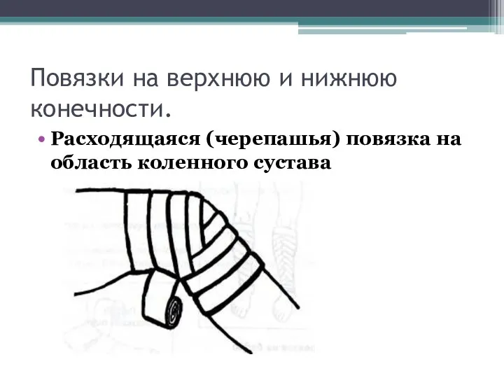 Повязки на верхнюю и нижнюю конечности. Расходящаяся (черепашья) повязка на область коленного сустава