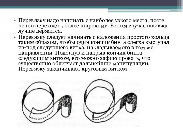 Перевязку надо начинать с наиболее узкого места, посте­пенно переходя к