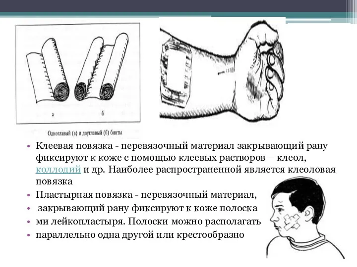 Клеевая повязка - перевязочный материал закрывающий рану фиксируют к коже