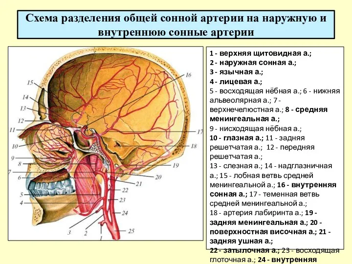 Схема разделения общей сонной артерии на наружную и внутреннюю сонные артерии 1 -