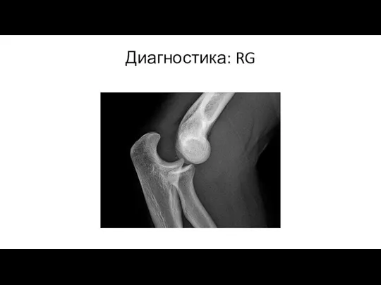 Диагностика: RG