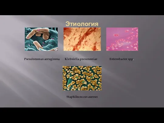 Этиология Pseudomonas aeruginosa Klebsiella pneumoniae Enterobacter spp. Staphilococcus aureus