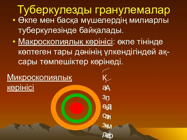 Туберкулезды гранулемалар Өкпе мен басқа мүшелердің милиарлы туберкулезінде байқалады. Макроскопиялық