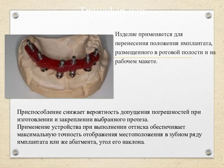 Трансфер-чек Изделие применяется для перенесения положения имплантата, размещенного в ротовой