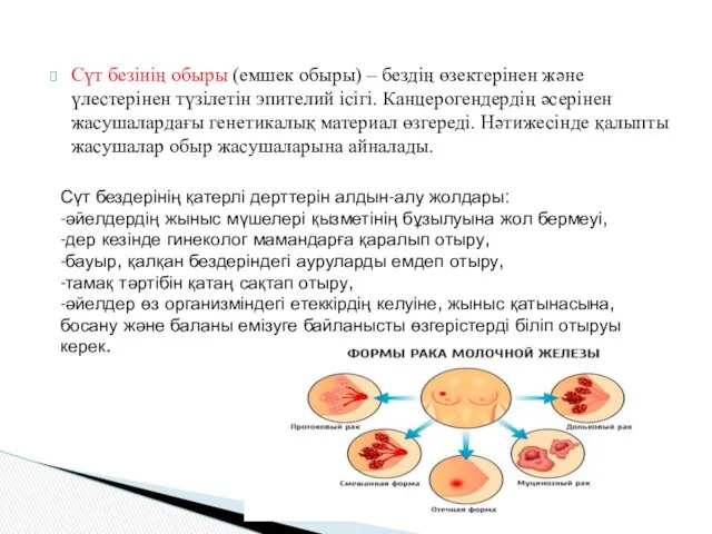 Сүт безінің обыры (емшек обыры) – бездің өзектерінен және үлестерінен