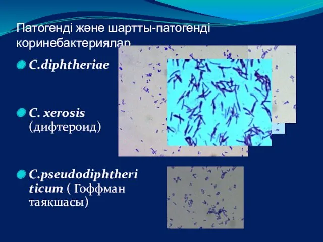 Патогенді және шартты-патогенді коринебактериялар C.diphtheriae C. xerosis (дифтероид) C.pseudodiphtheri ticum ( Гоффман таяқшасы)