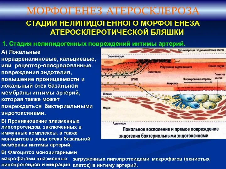 СТАДИИ НЕЛИПИДОГЕННОГО МОРФОГЕНЕЗА АТЕРОСКЛЕРОТИЧЕСКОЙ БЛЯШКИ 1. Стадия нелипидогенных повреждений интимы