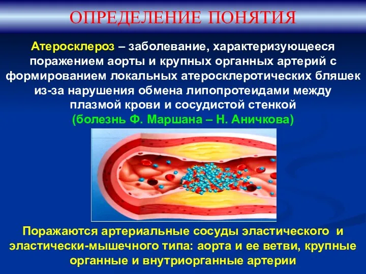 ОПРЕДЕЛЕНИЕ ПОНЯТИЯ Атеросклероз – заболевание, характеризующееся поражением аорты и крупных