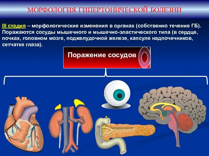 МОРФОЛОГИЯ ГИПЕРТОНИЧЕСКОЙ БОЛЕЗНИ III стадия – морфологические изменения в органах