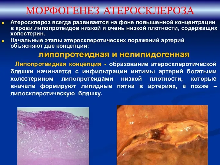 МОРФОГЕНЕЗ АТЕРОСКЛЕРОЗА Атеросклероз всегда развивается на фоне повышенной концентрации в