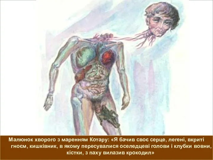 Малюнок хворого з маренням Котару: «Я бачив своє серце, легені, вкриті гноєм, кишківник,