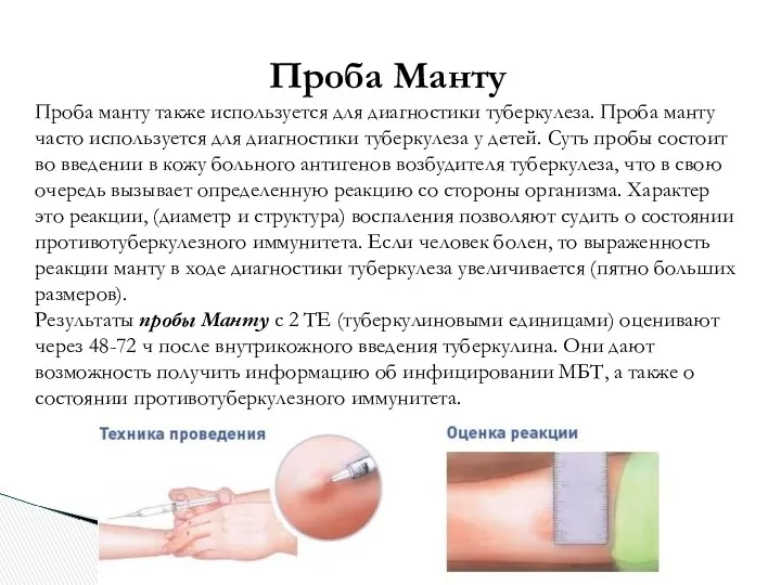 Проба Манту Проба манту также используется для диагностики туберкулеза. Проба манту часто используется
