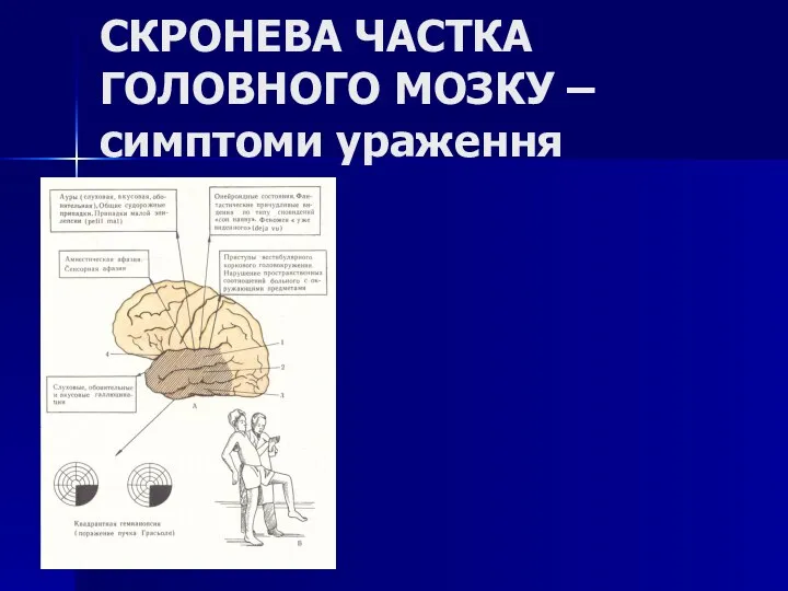 СКРОНЕВА ЧАСТКА ГОЛОВНОГО МОЗКУ – симптоми ураження