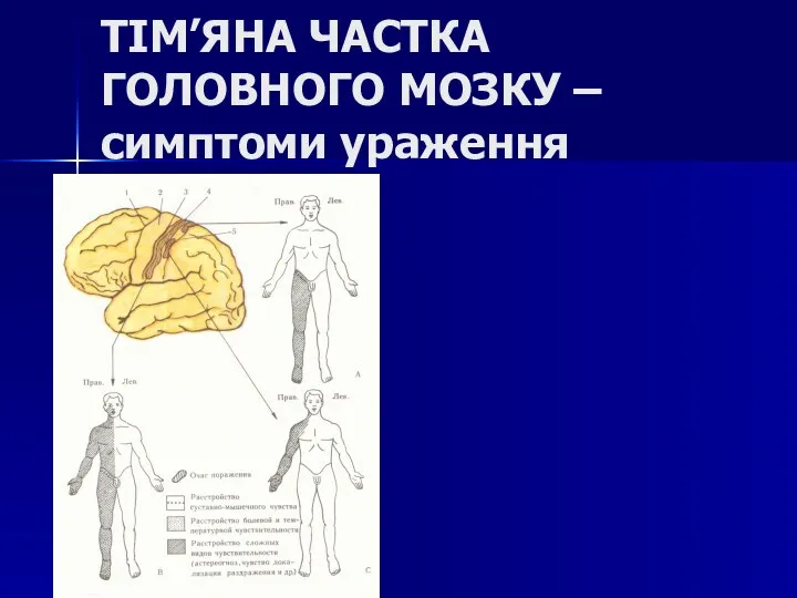 ТІМ’ЯНА ЧАСТКА ГОЛОВНОГО МОЗКУ – симптоми ураження