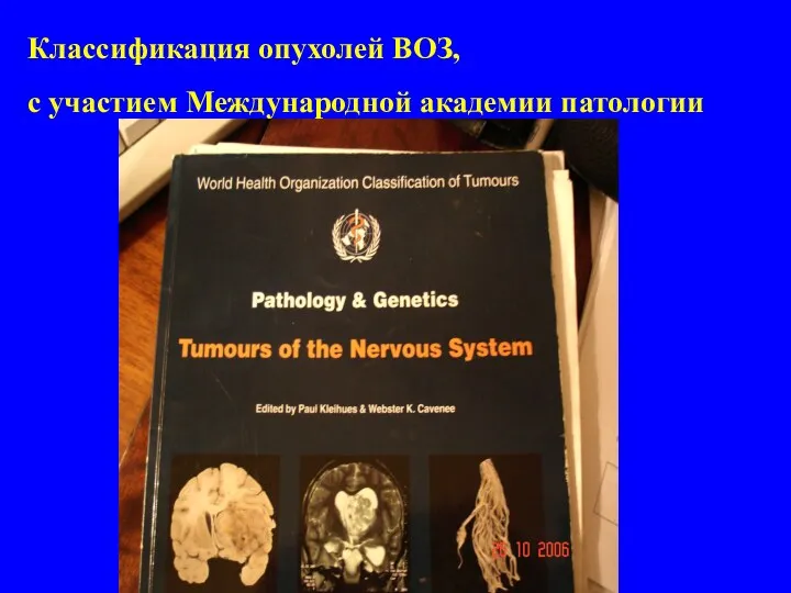 Классификация опухолей ВОЗ, с участием Международной академии патологии