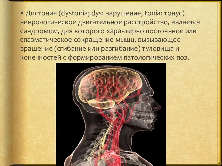 • Дистония (dystonia; dys: нарушение, tonia: тонус) неврологическое двигательное расстройство, является синдромом, для