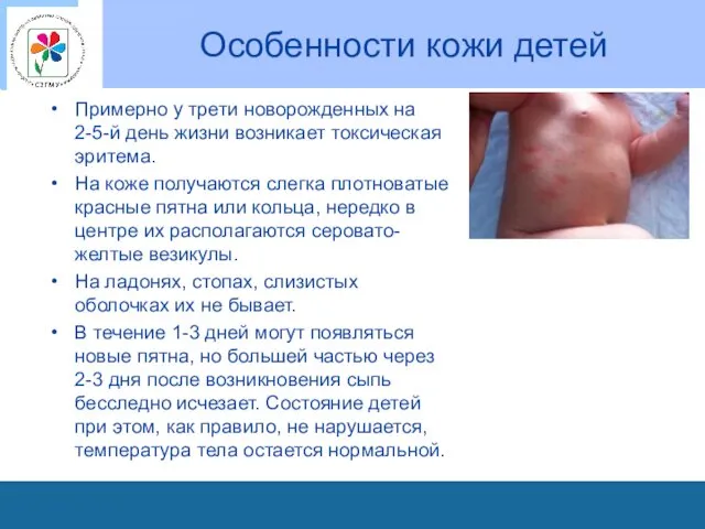 Особенности кожи детей Примерно у трети новорожденных на 2-5-й день