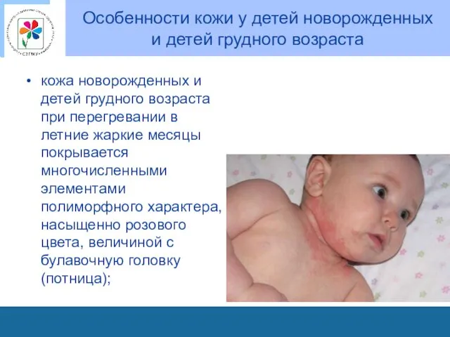 Особенности кожи у детей новорожденных и детей грудного возраста кожа