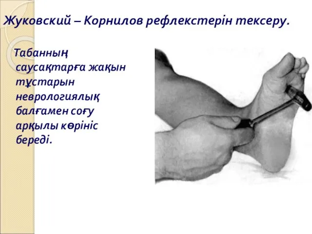 Жуковский – Корнилов рефлекстерін тексеру. Табанның саусақтарға жақын тұстарын неврологиялық балғамен соғу арқылы көрініс береді.