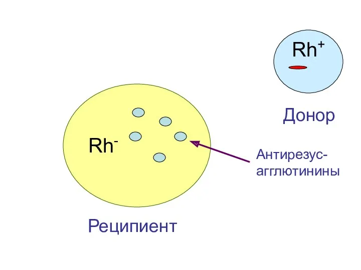 Rh- Реципиент Rh+ Донор Антирезус- агглютинины