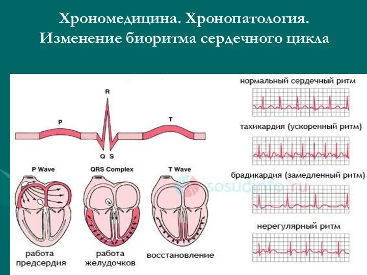 Хрономедицина. Хронопатология. Изменение биоритма сердечного цикла