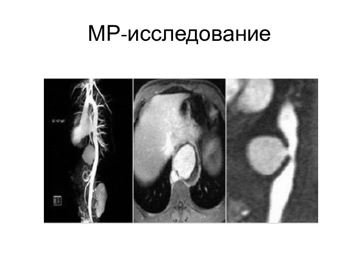 МР-исследование