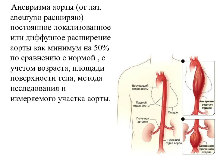 Аневризма аорты (от лат. aneuryno расширяю) – постоянное локализованное или