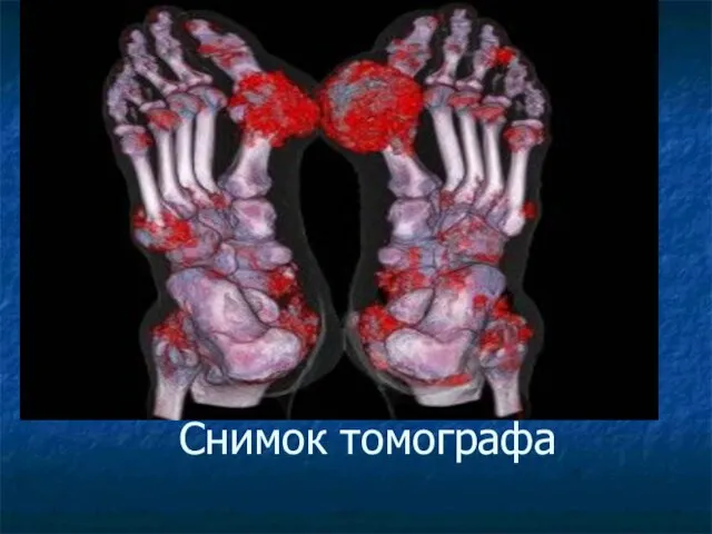 Снимок томографа