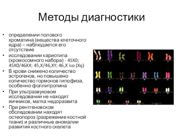 Методы диагностики определении полового хроматина (вещества клеточного ядра) – наблюдается