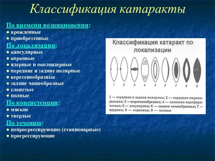 Классификация катаракты По времени возникновения: ● врожденные ● приобретенные По