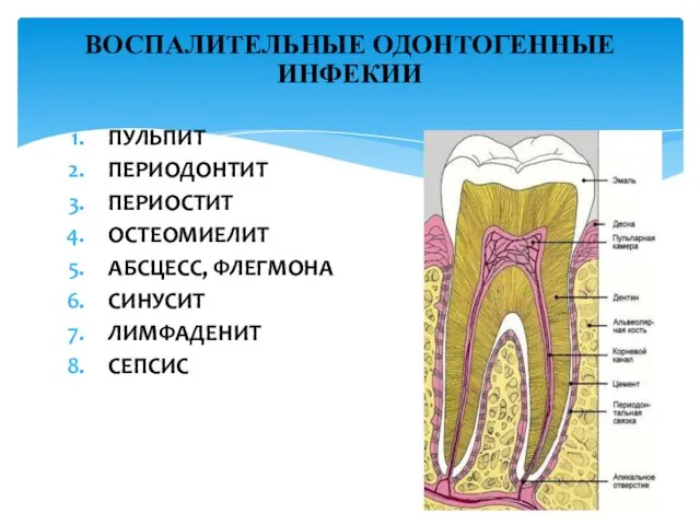 ПУЛЬПИТ ПЕРИОДОНТИТ ПЕРИОСТИТ ОСТЕОМИЕЛИТ АБСЦЕСС, ФЛЕГМОНА СИНУСИТ ЛИМФАДЕНИТ СЕПСИС ВОСПАЛИТЕЛЬНЫЕ ОДОНТОГЕННЫЕ ИНФЕКИИ