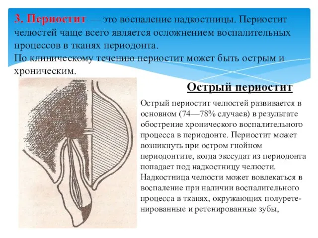 3. Периостит — это воспаление надкостницы. Периостит челюстей чаще всего