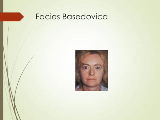 Facies Basedovica