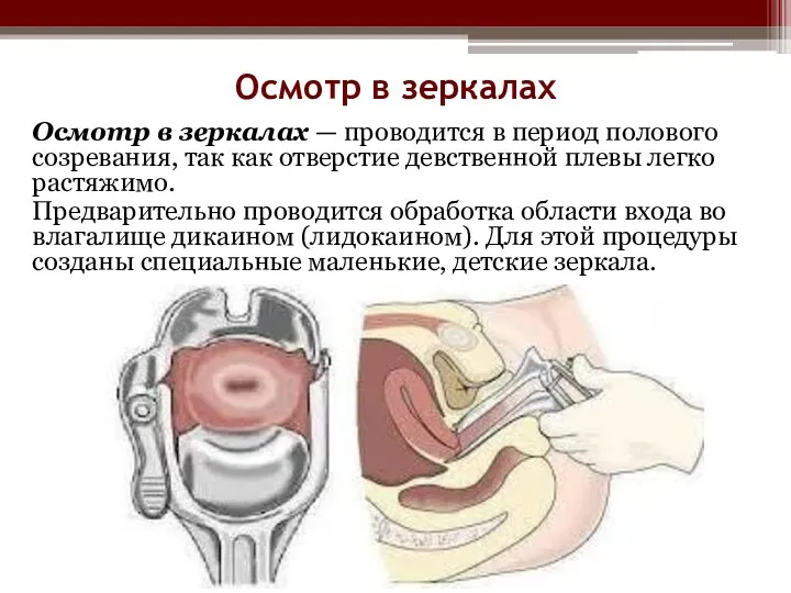 Осмотр в зеркалах Осмотр в зеркалах — проводится в период