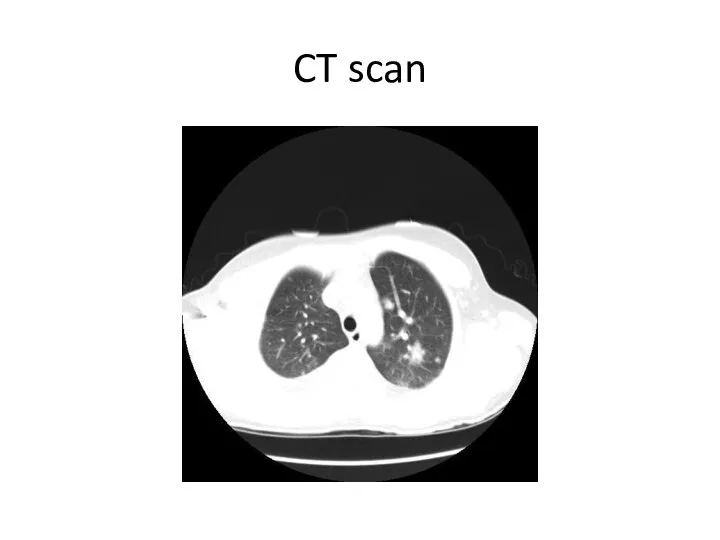 CT scan