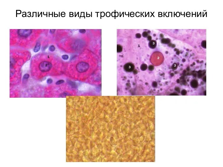 Различные виды трофических включений