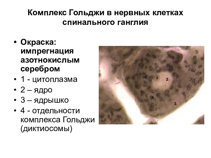 Комплекс Гольджи в нервных клетках спинального ганглия Окраска: импрегнация азотнокислым