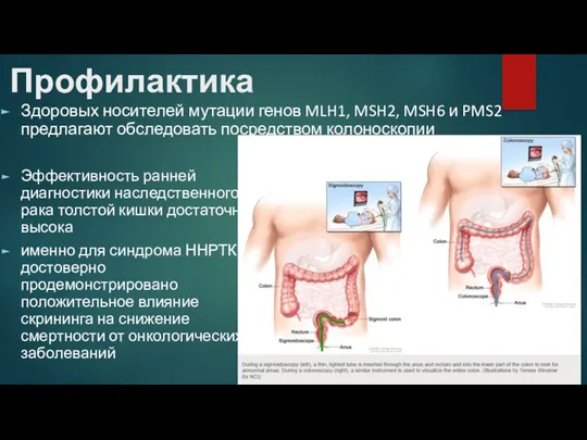 Здоровых носителей мутации генов MLH1, MSH2, MSH6 и PMS2 предлагают обследовать посредством колоноскопии