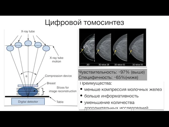 Цифровой томосинтез Чувствительность: ∼97% (выше) Специфичность: ∼65%(ниже)