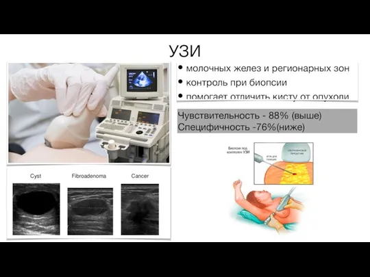 УЗИ Чувствительность - 88% (выше) Специфичность -76%(ниже)