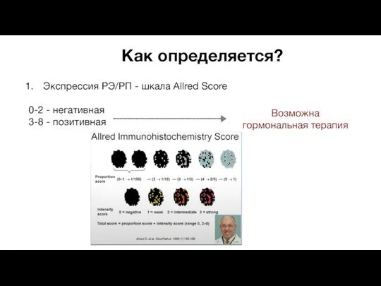 Как определяется? Экспрессия РЭ/РП - шкала Allred Score 0-2 -