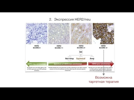 2. Экспрессия HER2/neu Возможна таргетная терапия