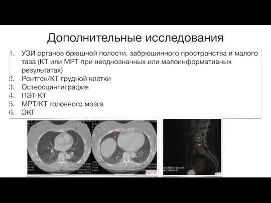 Дополнительные исследования