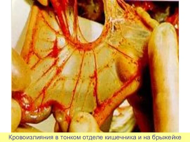 Кровоизлияния в тонком отделе кишечника и на брыжейке